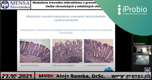 MENSA Slovensko o úloze mikrobiomu při podpoře zdraví, prevenci vzniku a rozvoje nemocí